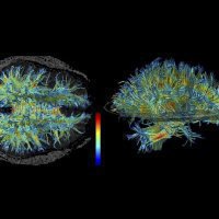 Ученые: Размер мозга зависит от благосостояния человека