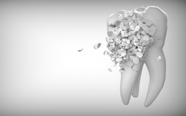 ИОФ РАН и МИФИ разработали технологию лазерной диагностики повреждений зубов