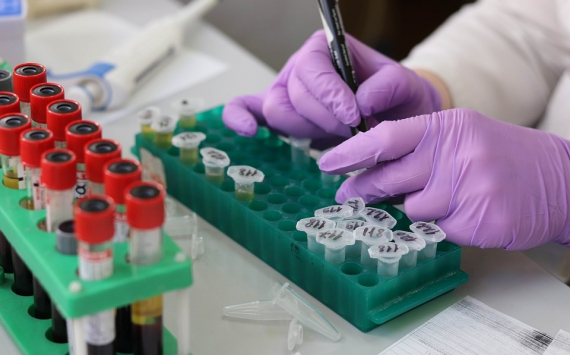Компания «Фосагро» передала в регионы своего присутствия тесты для выявления коронавируса