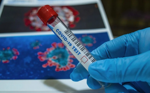 Ученые обнаружили антитело от всех штаммов коронавируса