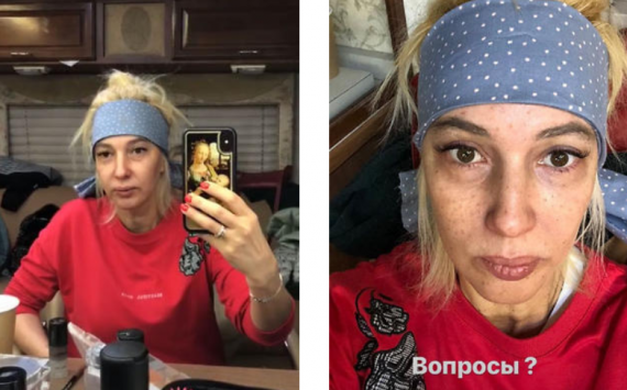 Лера Кудрявцева неприятно удивила фанатов «голым» лицом