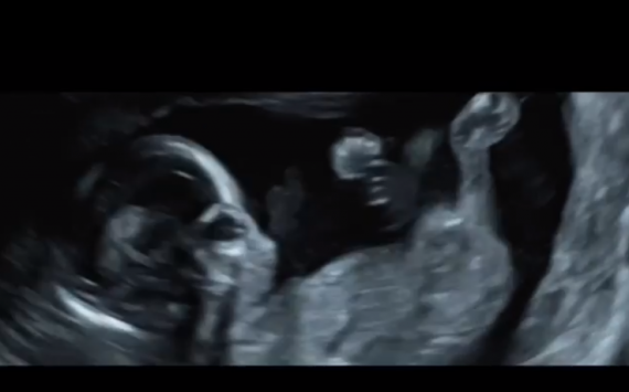 Нюша показала будущего ребенка в клипе на песню «Таю»